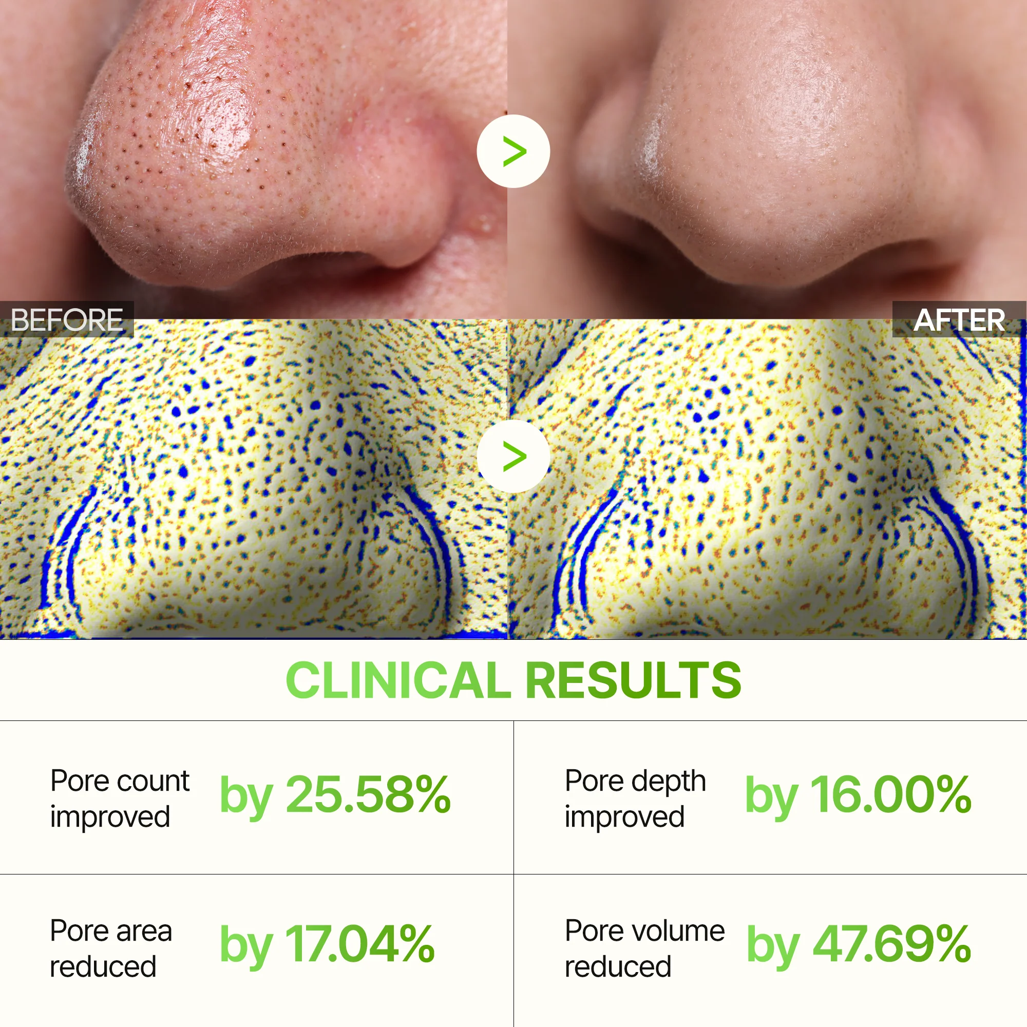 CACTOX 3-Step Nose Mask Pack - Image 4