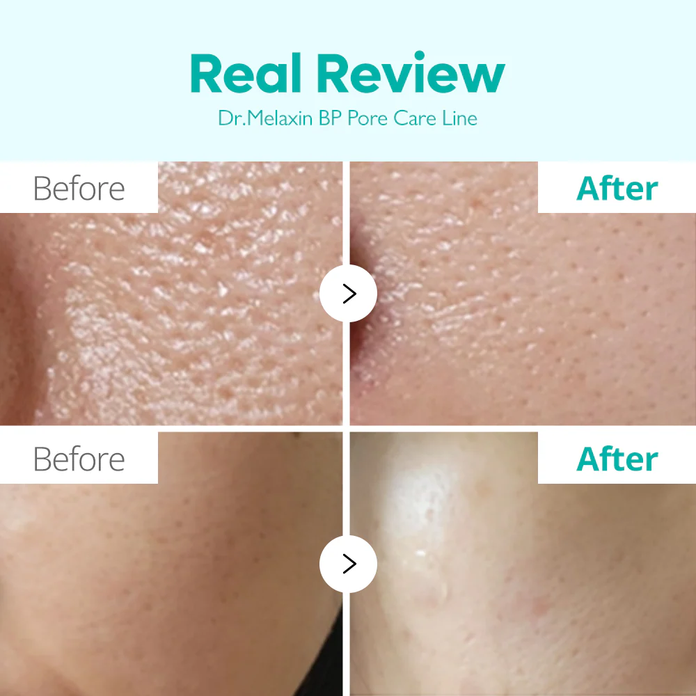 BP Pore Care Line - Image 5