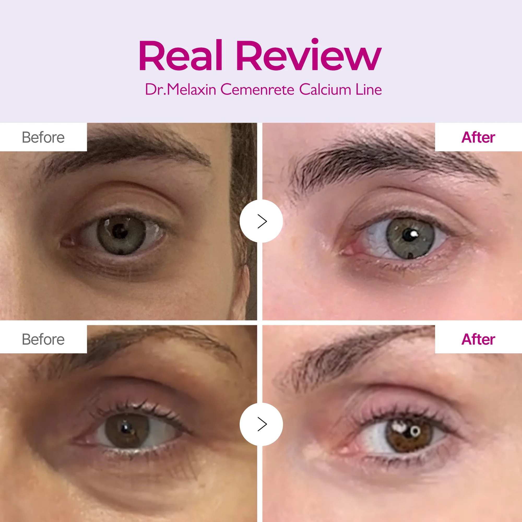 Calcium Eye Care Routine Set - Image 3