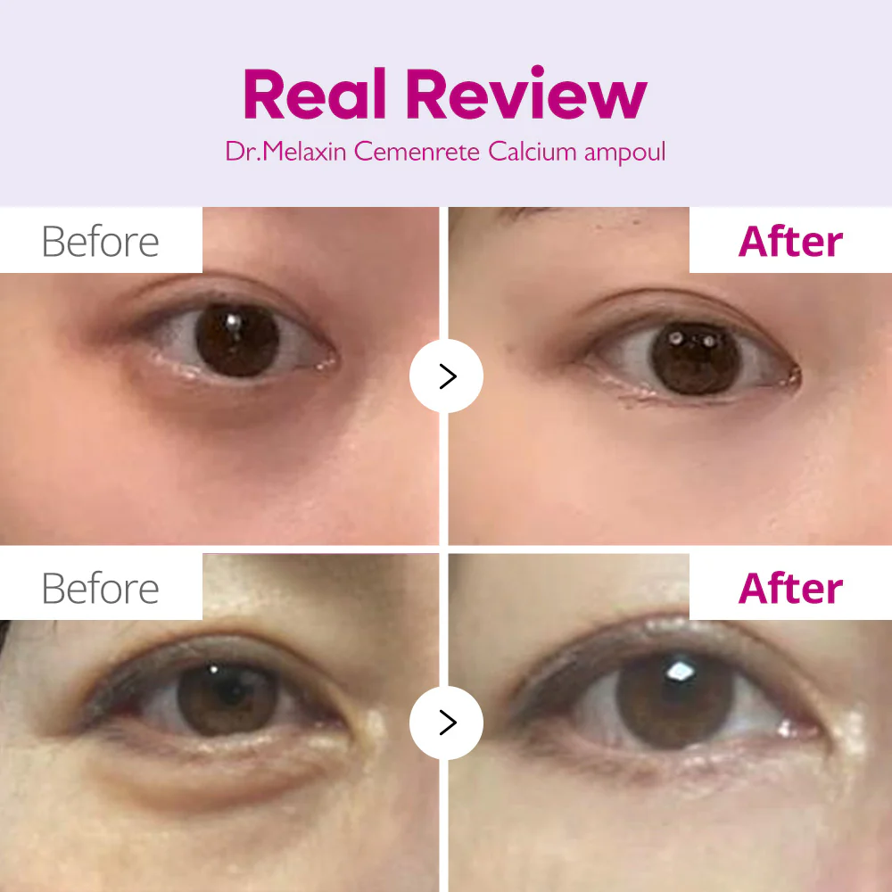 Cemenrete Calcium Intense Ampoule - Image 5