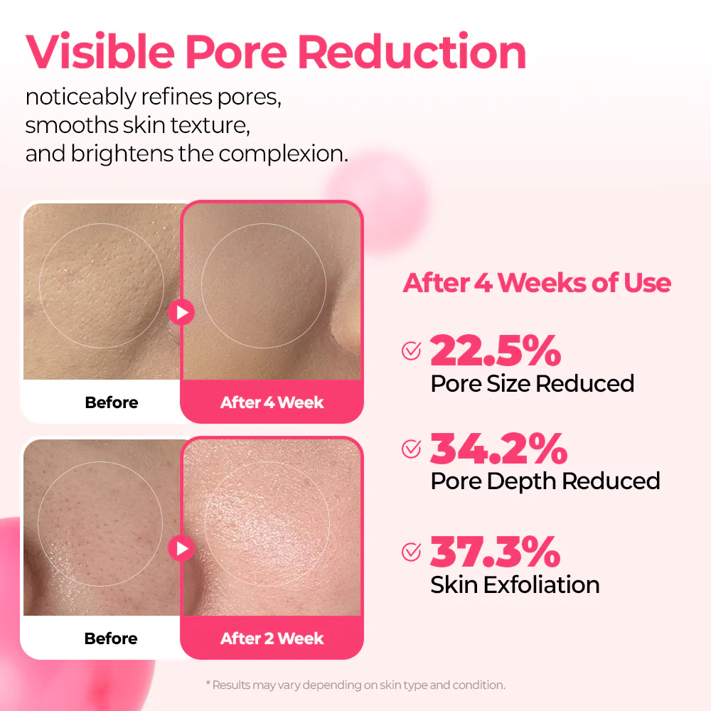 Cemenrete Cyano Pink Spicule Serum - Image 7