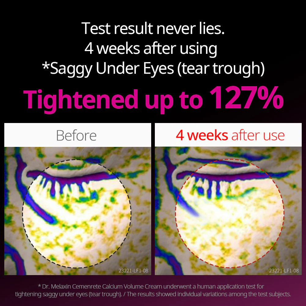 Cemenrete Eye care Line - Image 3