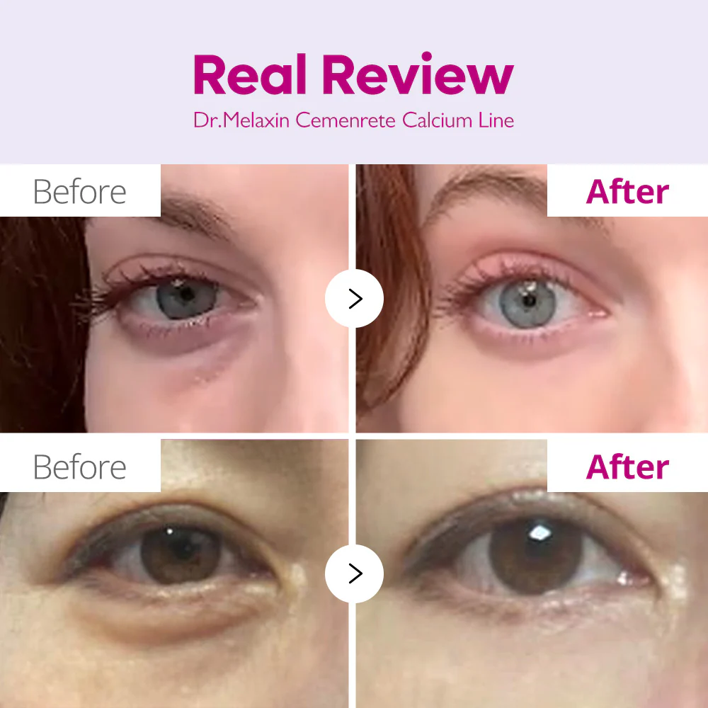 Cemenrete Eye care Line - Image 4