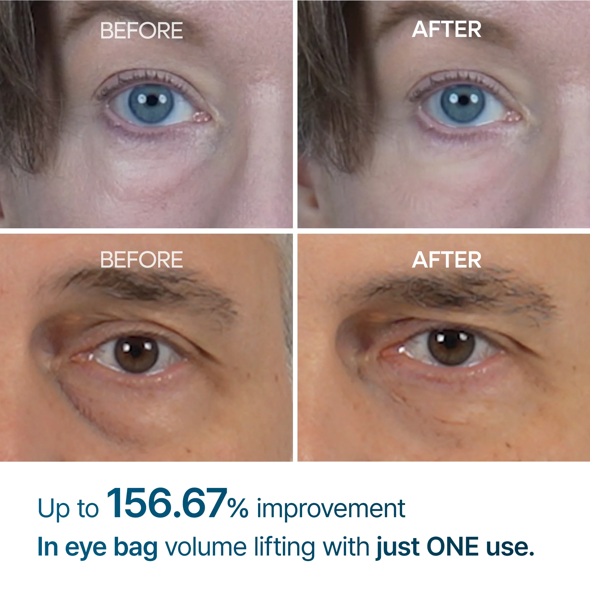 Eyephalt eyebag cream - Image 3