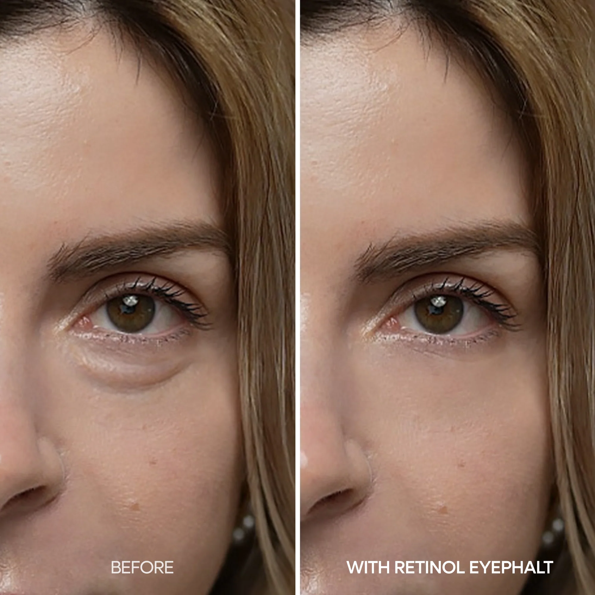 [Day&Night Care] Eyephalt Eyebag Lifting Line - Image 7