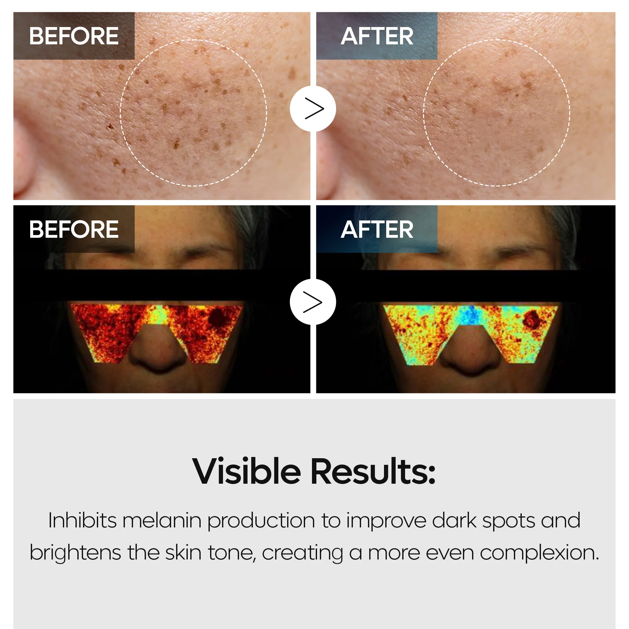 TX Tranexamic Acid Dark Spot Care Line - Image 3