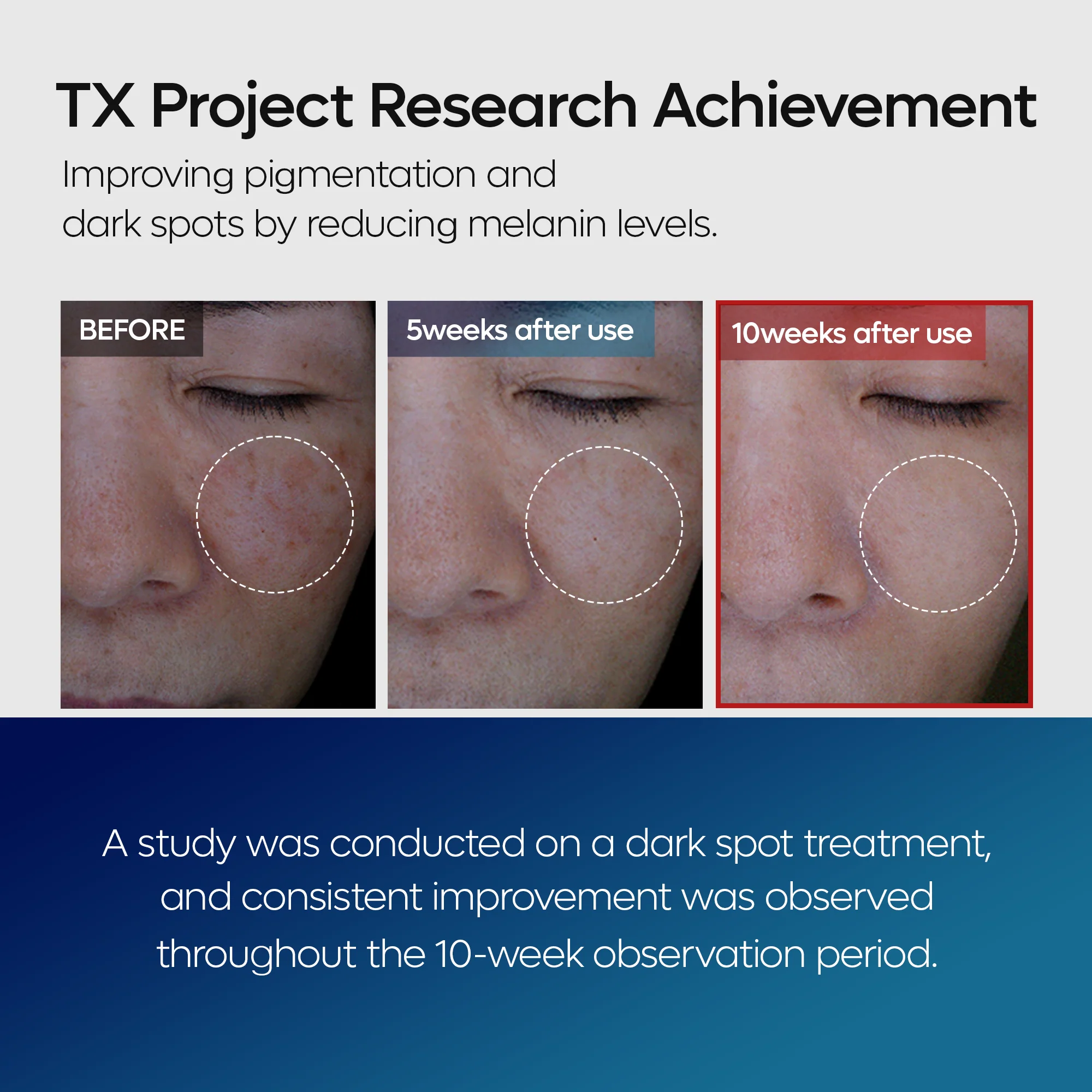 TX Tranexamic Acid Dark Spot Care Line - Image 6