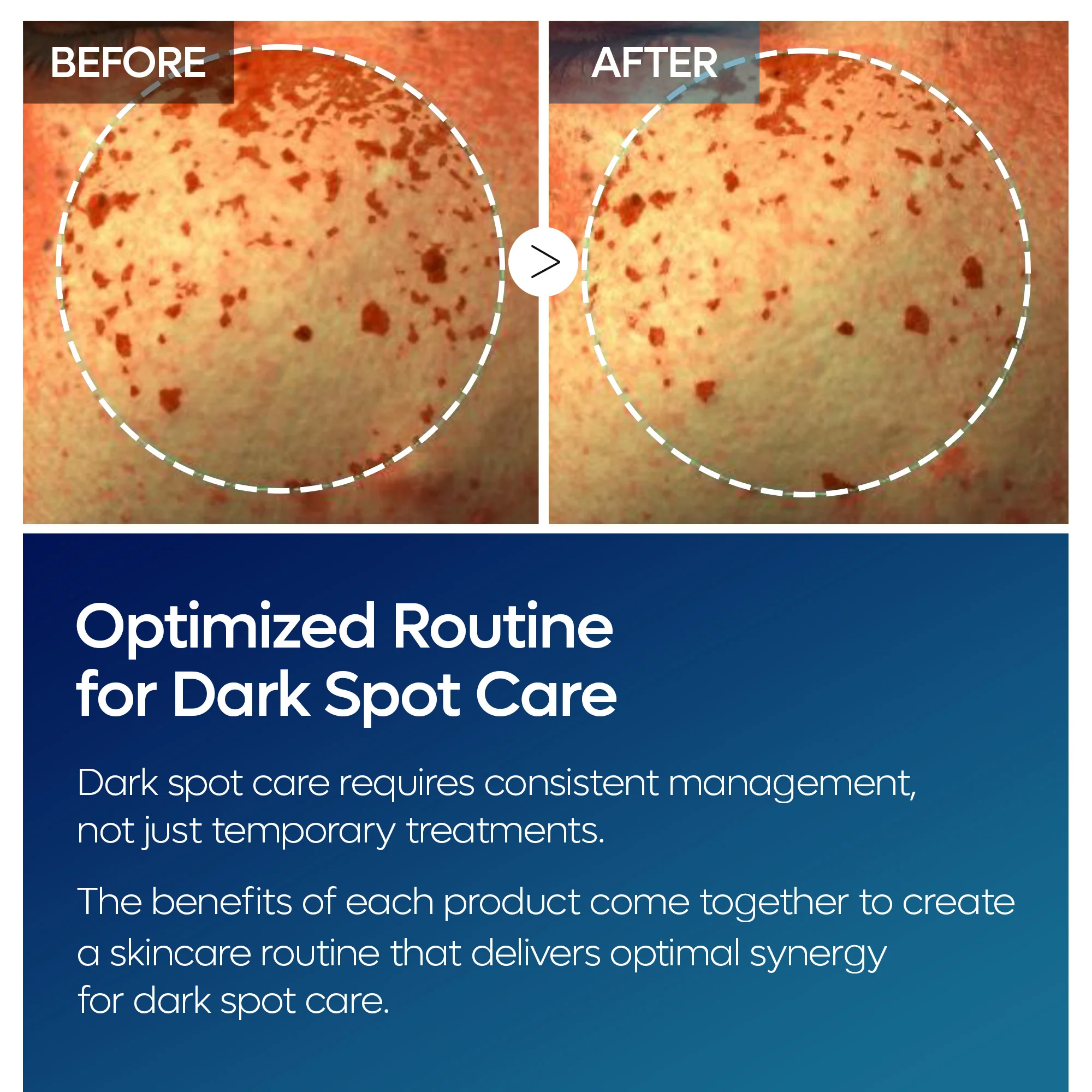TX Tranexamic Acid Dark Spot Care Line - Image 7
